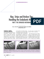 Dentistry - Broken File Tip 2