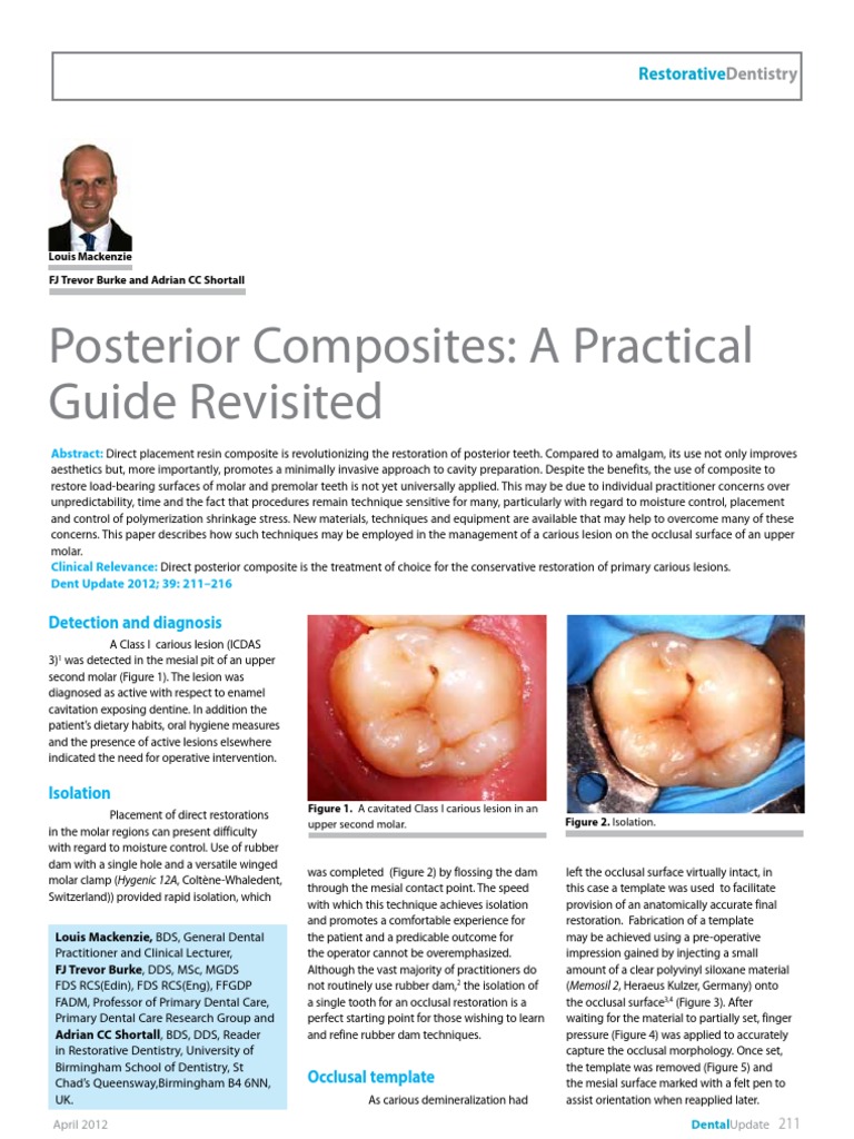 Posterior Composites A Practical Guide Revisited Restorative PDF