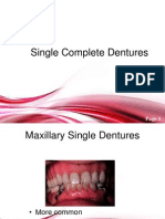 Single Complete Dentures