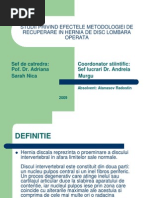 Hernia De Disc