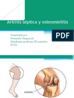 Artritis séptica y osteomielitis