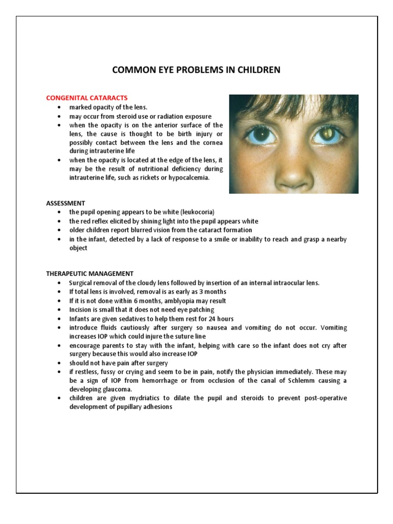 Common Eye Problems In Children Pdf Medical Specialties Ophthalmology