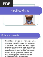 Hipotireoidismo