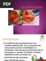 QUEIMADURAS