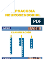 Hipoacusia Neurosensorial