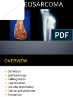 Osteosarcoma