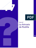 Artrosis de Rodilla