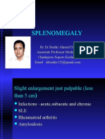Massive Splenomegaly by Dr Bashir Ahmed Dar  Sopore Kashmir Associate Professor Medicine