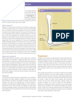 Cubital Tunel Syndrome