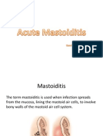 Acute Mastoiditis