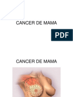 Cancer de Mama