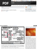 Organized Stalking Electronic Harassment - Allen Barker's Models of Synthetic Telepathy - Targetedindividualscanada Audio - Recording