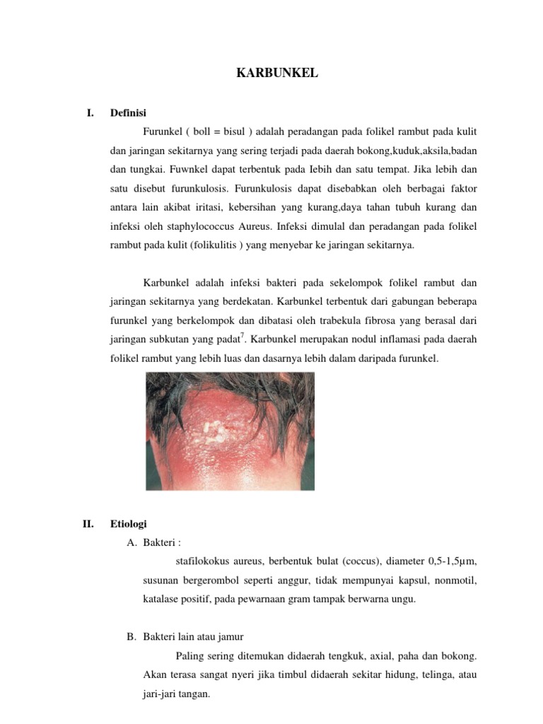 Karbunkel: Definisi, Penyebab, dan Penanganan | PDF