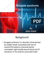 Brugada Syndrome