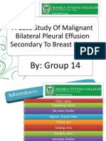 A Case Study Of Malignant Bilateral Pleural Effusion Secondary To Breast Cancer