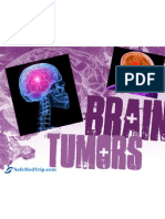Most Advanced Brain Tumor Treatment Available at World Class Hospitals in India