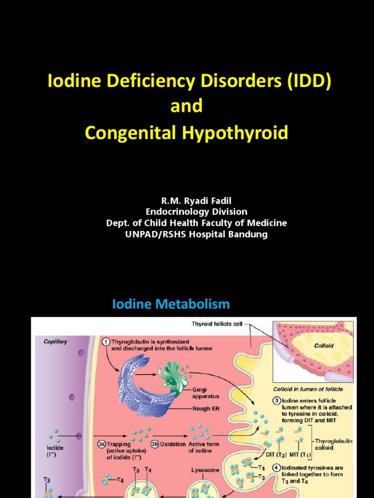 Iodine Deficiency Disorders (IDD) and Congenital Hypothyroid PDF Thyroid Hypothyroidism