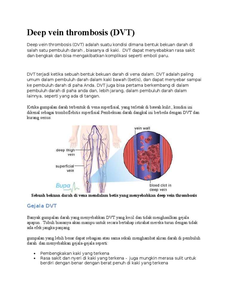 Deep Vein Thrombosis | PDF | Perjalanan | Sains & Matematika