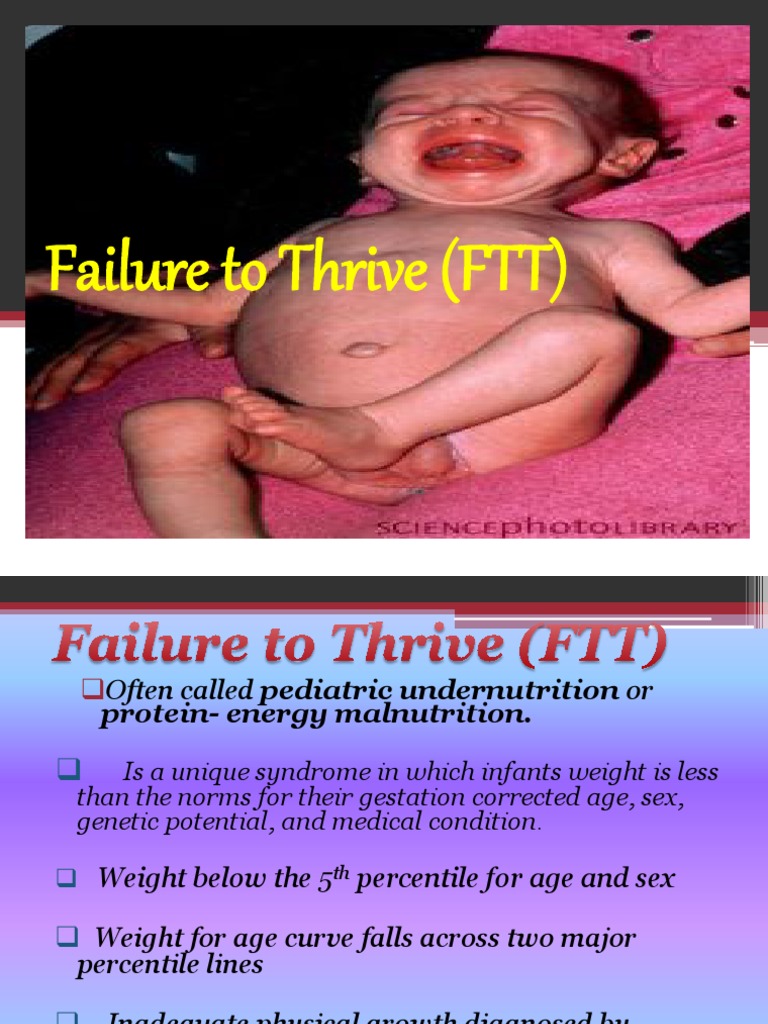 Failure To Thrive Ftt Pdf Malnutrition Eating