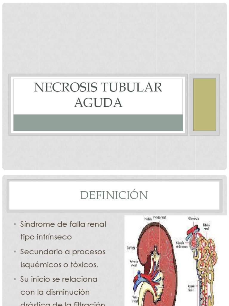 necrosis-tubular-aguda-pdf-especialidades-medicas-medicina-clinica