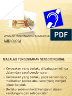 Masalah Pendengaran Sensorineural