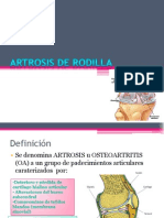 Artrosis de Rodilla