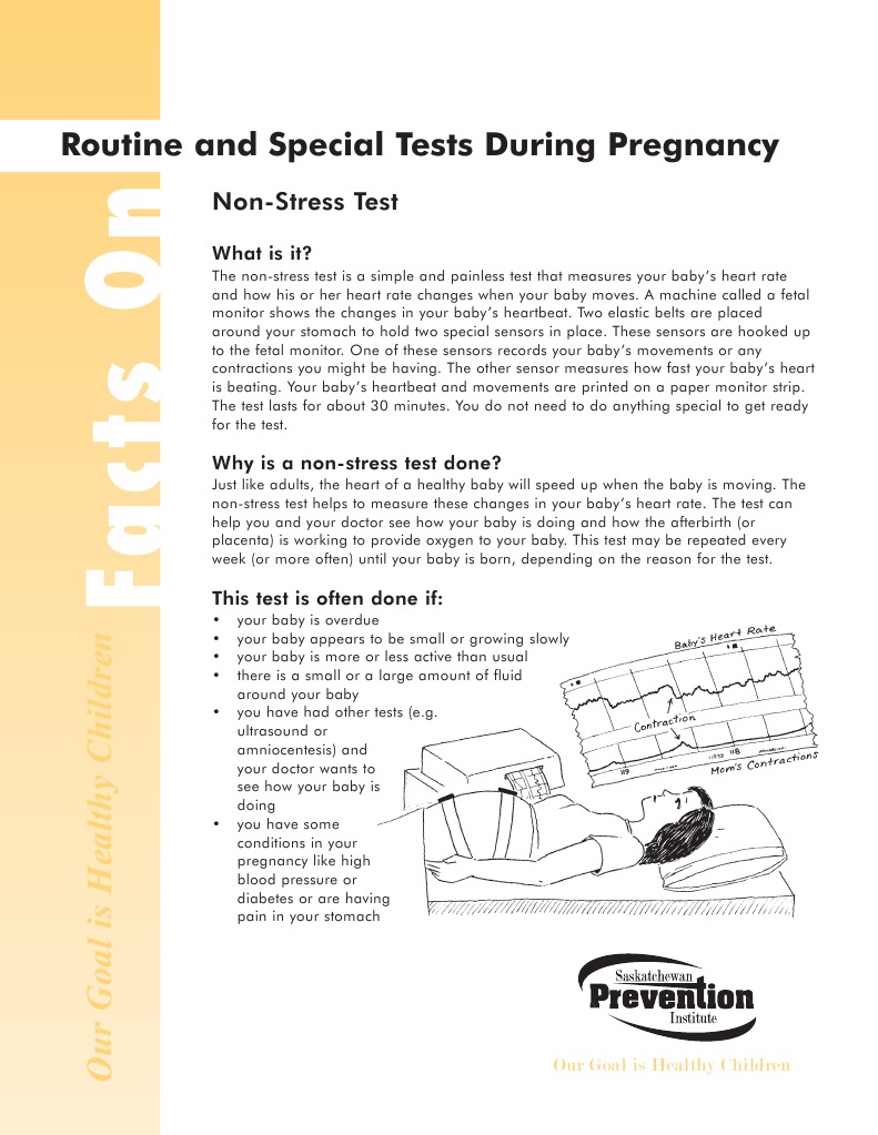 NonStress Test Heart Rate Heart