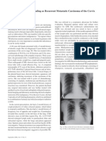 Tuberculosis Masquerading As Recurrent Metastatic Carcinoma of The Cervix