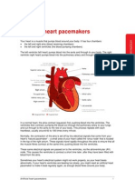 Artifical Heart Pacemakers
