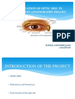 Localization of Optic Disc in Fluorescein Angiography Images