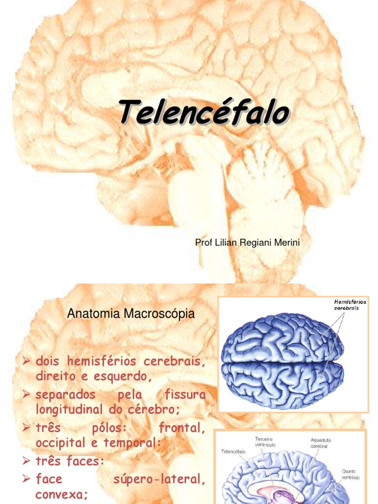 Sistema Cerebrovascular | Concise Medical Knowledge, image size:768x1024