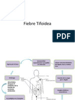 Fiebre Tifoidea.ppt