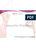 Liposuction - Sculpt and Shape Your Body.