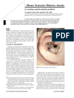 Partial Auricular Prosthesis