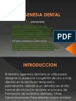 Agenesia Dental (1)