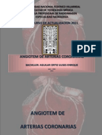 Angiografía coronaria TC