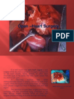 Open Heart Surgery