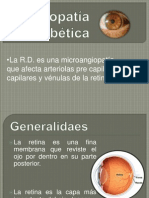 Retinopatía Diabética