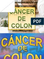 Cancer de Colon