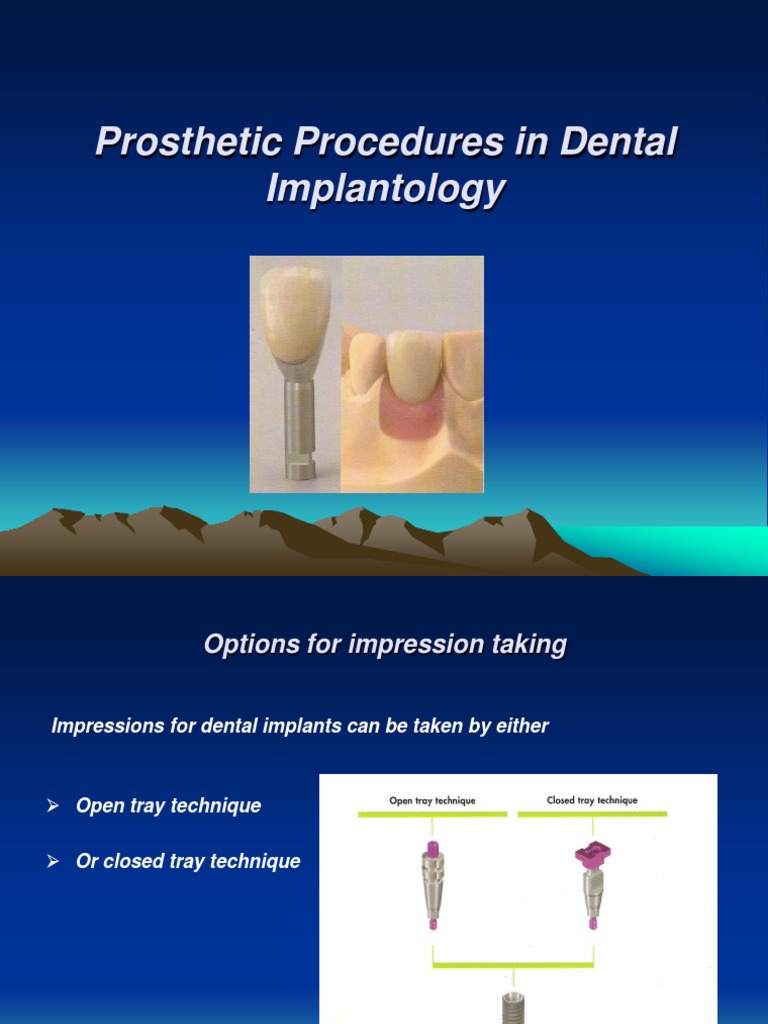Prosthetic Procedures in Dental Implantology PDF Dental Implant