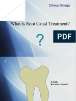 Root Canal Treatment