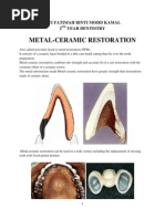 Metal Ceramic Restoration