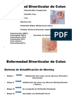 Seminario de Enfermedad Diverticular de Colon