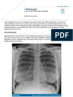 Interpreting The Chest Radiograph