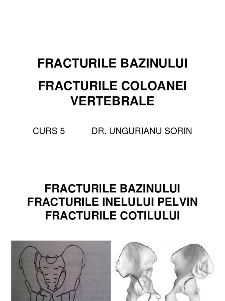for me essay chess Curs 5 Fracturile Bazinului | PDF