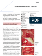 Mouth Ulcers and Other Causes of Orofacial Soreness and Pain