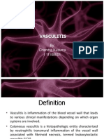 Vasculitis