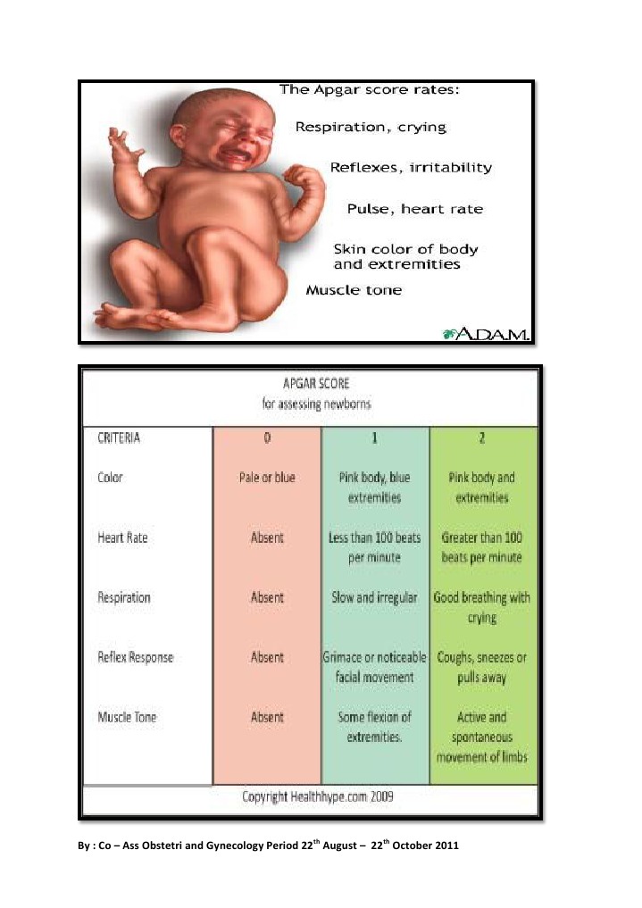 Apgar Score | PDF