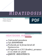 Hidatidosis