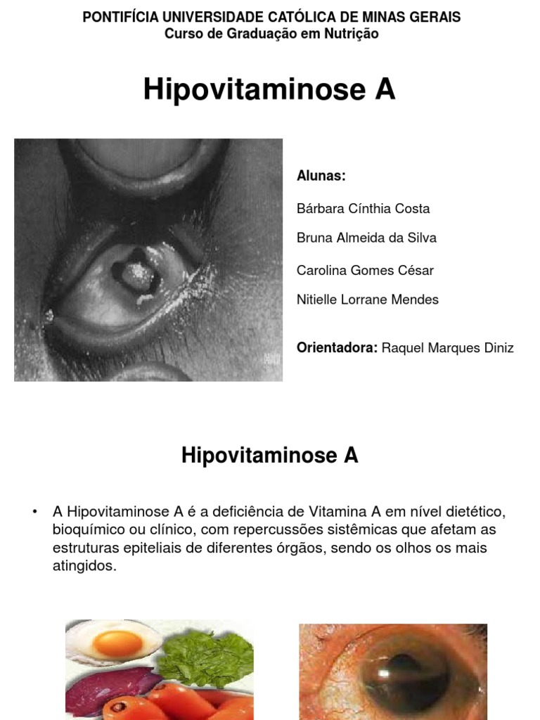 Hipovitaminose A: Causas e Tratamento | PDF | Vitamina A | Vitamina